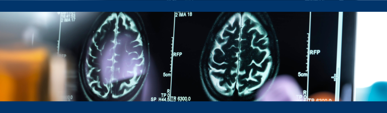 Picture of brain in x-ray